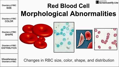 红细胞形态异常