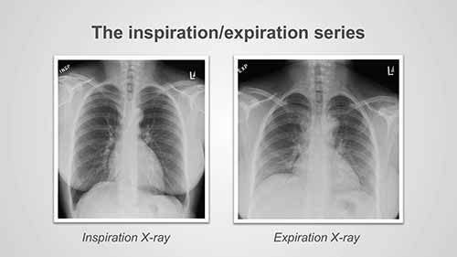 X射线检查的类型